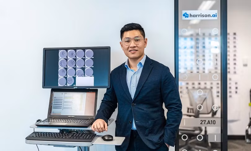 Aengus Tran (Đình Áng) được anh trai gọi là linh hồn của dự án vì đã tạo ra công nghệ từ khi Minh Trí còn ngồi ghế giảng đường Đại học y New South Wales