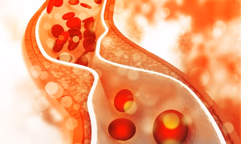 Có quá nhiều cholesterol trong máu ảnh hưởng lớn tới sức khỏe tim mạch.