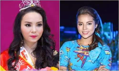 Hoa hậu Kỳ Duyên bị thẩm mỹ viện "tố" dùng dao kéo ảnh 3