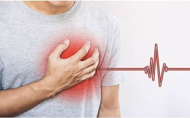 Bệnh nhồi máu cơ tim và đột quỵ thường bị nhầm lẫn, khiến cho việc điều trị, sơ cứu gặp khó khăn.