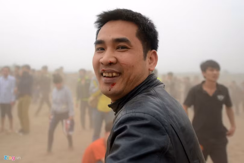 Một trong những thanh niên đã bị đổ máu sau khi thoát ra khỏi "cơn lốc" tranh cướp.