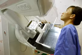 Bệnh nhân chụp Xquang vú tại Bệnh viện Bạch Mai