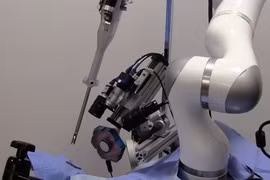 Robot đang chứng tỏ khả năng phẫu thuật tài tình (ảnh: BGR)