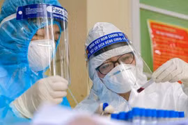 Xét nghiệm SARS-CoV-2 khẳng định COVID-19 bằng phương pháp Realtime RT-PCR - Ảnh: BYT 