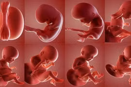 Nguyên nhân gây nên dị tật bẩm sinh hiếm gặp ở trẻ em