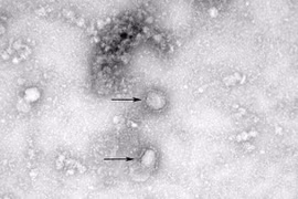 Hình ảnh virus corona chủng mới dưới ống kính hiển vi (Ảnh: Đông Phương)