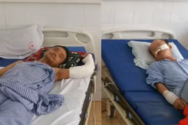 2 bệnh nhân đang điều trị tại Bệnh viện 198.