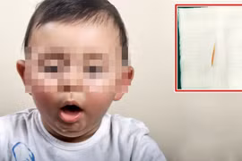 Bé gái hơn 1 tuổi nuốt cây tăm dài 5cm vào dạ dày. Ảnh minh họa
