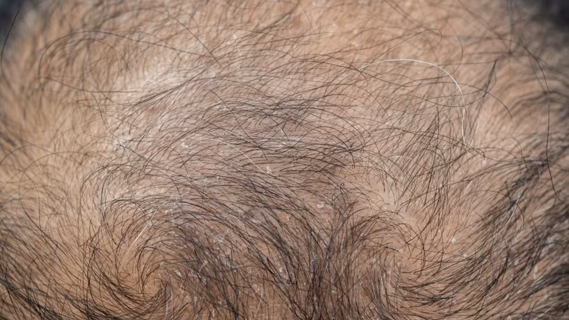 Ảnh minh họa: PM.