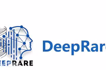Hệ thống AI y tế DeepRare được coi là bước đột phá lớn trong việc giải quyết khó khăn trong chẩn đoán bệnh hiếm gặp. Ảnh: Baike. 