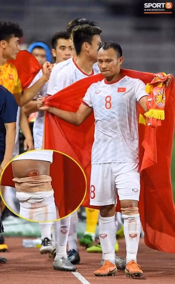 Trọng Hoàng là cầu thủ U22 Việt Nam bị đối phương chơi xấu nhiều nhất. Ảnh VFF