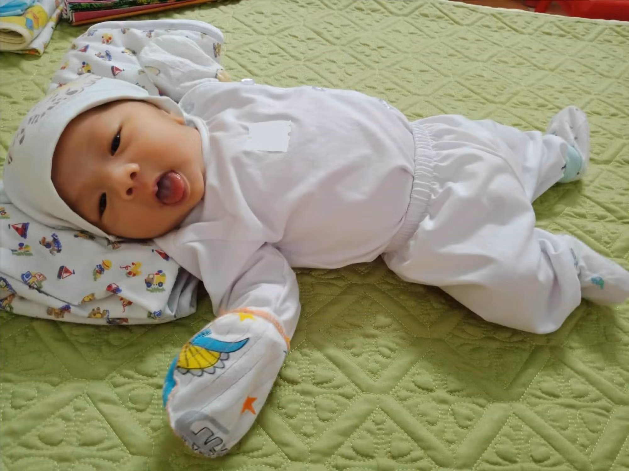 Bé Đậu Xanh chào đời nặng 3.8kg bằng phương pháp sinh mổ (Ảnh - BVCC)