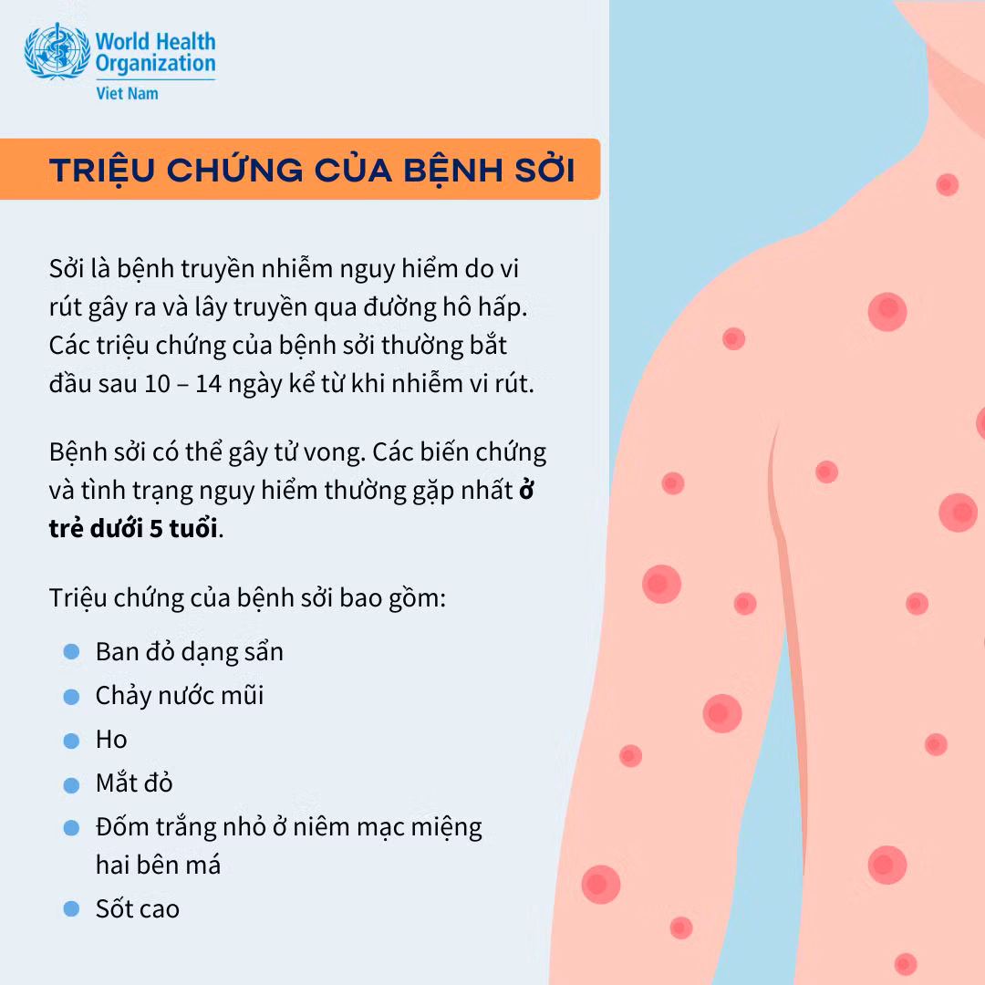 Sởi 1.png