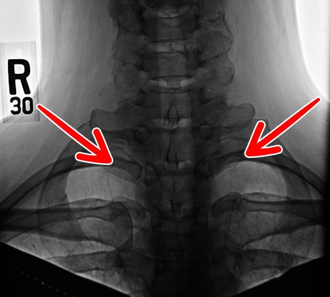 15 bộ phận trên cơ thể con người sẽ biến mất trong tương lai ảnh 5