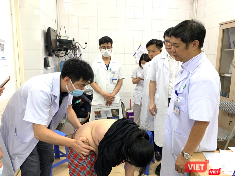 Bé Nguyễn Hà Tr. ở Bắc Ninh, 11 tuổi, bị vẹo cột sống tới 59-60 độ