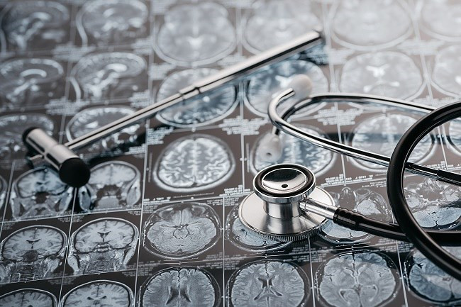 Cuộc sống của bạn sẽ thay đổi ra sao nếu không ngủ? ảnh 6