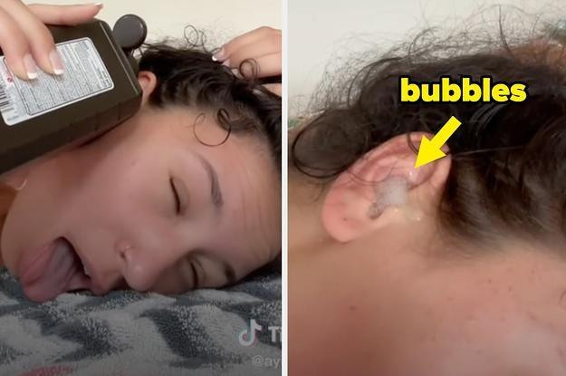 Tiktoker Ayisha sử dụng dung dịch oxy già để làm sạch tai. Ảnh: BuzzFeed. Tiktoker Ayisha sử dụng dung dịch oxy già để làm sạch tai. Ảnh: BuzzFeed.