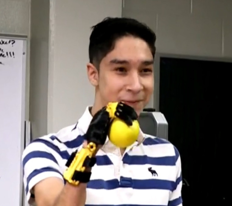 Học sinh Sergio Peralta với bàn tay giả robot bắt được quả bóng. Ảnh CBS News Học sinh Sergio Peralta với bàn tay giả robot bắt được quả bóng. Ảnh CBS News