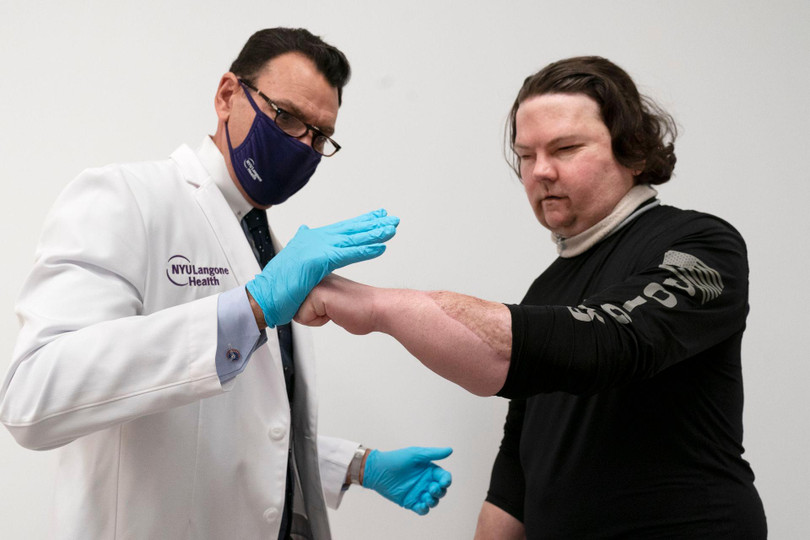 DiMeo đang luyện tập bàn tay mới (Ảnh: AP).