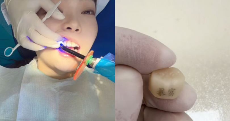 Một khách hàng trẻ đang làm thủ thuật "xăm răng" với hai chữ "Bạo phú" (Giàu nhanh). Ảnh: Orientaldaily.