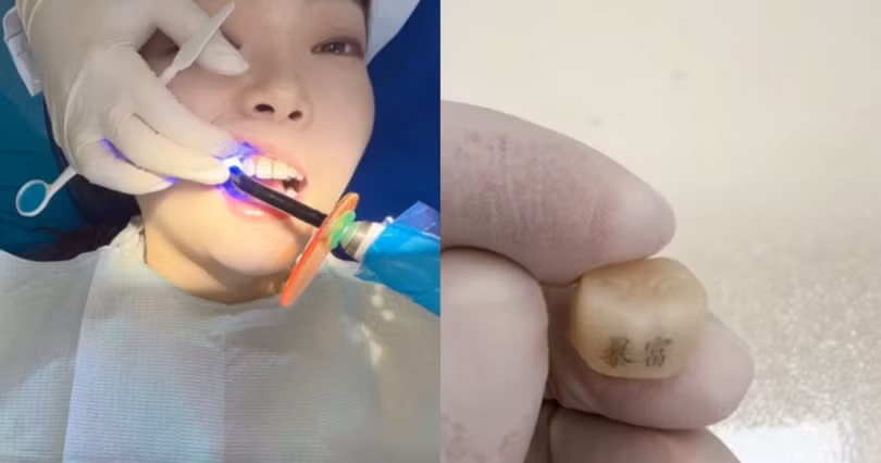 Một khách hàng trẻ đang làm thủ thuật "xăm răng" với hai chữ "Bạo phú" (Giàu nhanh). Ảnh: Orientaldaily.