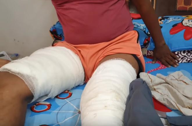 Chủ nhân của chiếc điện thoại bị thương ở chân do vụ nổ.