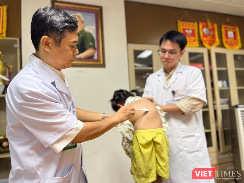 VT_vẹo bướu V.jpg