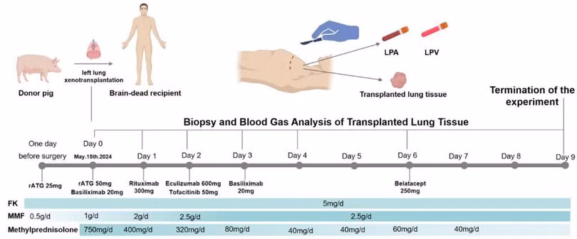 Phac do ca ghep phoi.jpg