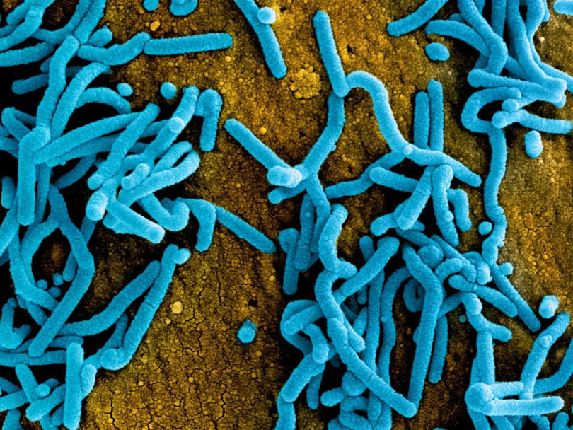 Virus Marburg có độc lực rất cao