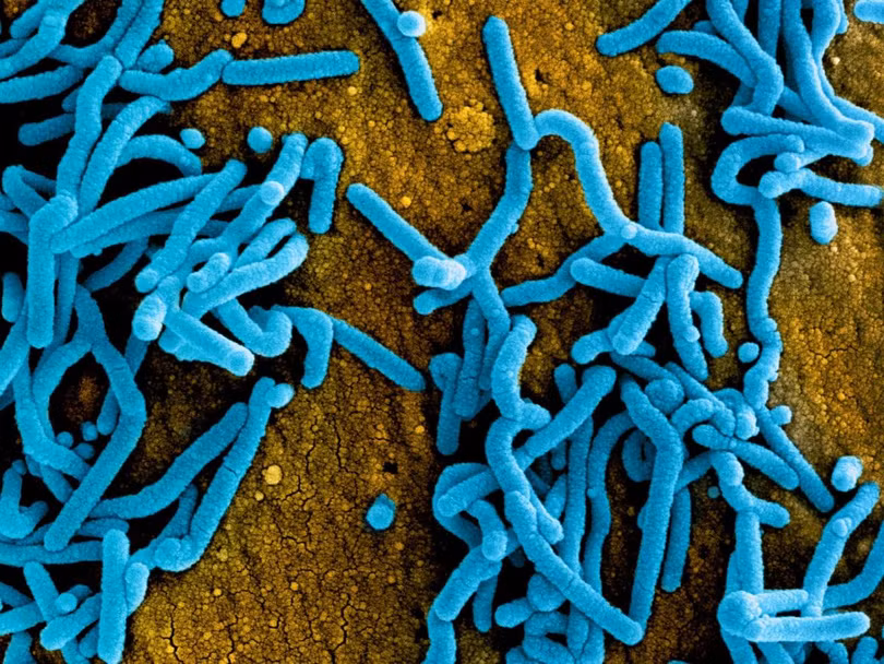 Virus Marburg có độc lực rất cao Virus Marburg có độc lực rất cao