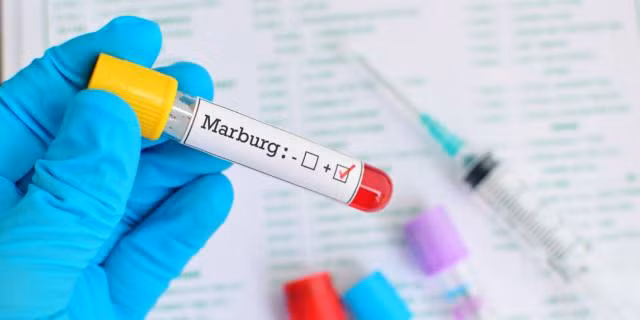 Virus Marburg khiến 9 người chết và WHO lập tức phải họp khẩn (ảnh: Bimbisaniebelli)