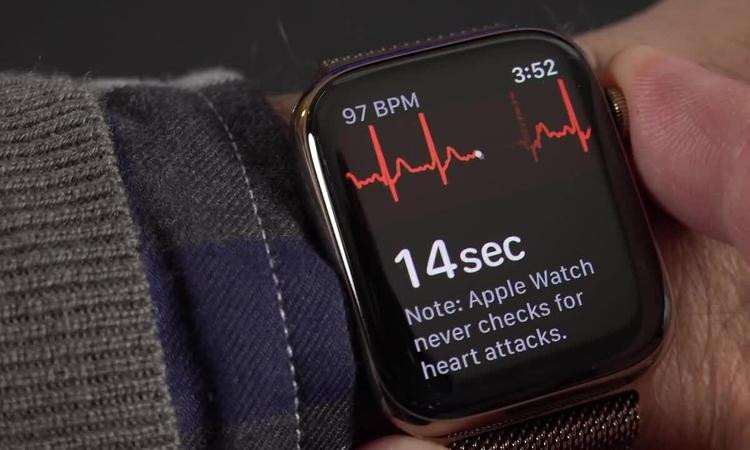 Thử đo điện tâm đồ bằng Apple Watch. Vide: YouTube DetroitBORG