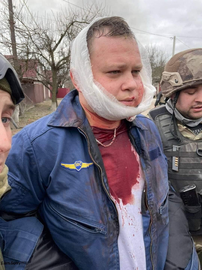 Thiếu tá Krasnoyastev, phi công át chủ bài của Nga bị bắt sau khi chiếc máy bay chiến đấu Su-34 của anh ta bị bắn rơi hôm 5/3 (Ảnh: Twitter). Thiếu tá Krasnoyastev, phi công át chủ bài của Nga bị bắt sau khi chiếc máy bay chiến đấu Su-34 của anh ta bị bắn rơi hôm 5/3 (Ảnh: Twitter).