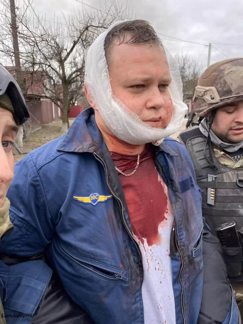 Thiếu tá Krasnoyastev, phi công át chủ bài của Nga bị bắt sau khi chiếc máy bay chiến đấu Su-34 của anh ta bị bắn rơi hôm 5/3 (Ảnh: Twitter). Thiếu tá Krasnoyastev, phi công át chủ bài của Nga bị bắt sau khi chiếc máy bay chiến đấu Su-34 của anh ta bị bắn rơi hôm 5/3 (Ảnh: Twitter).