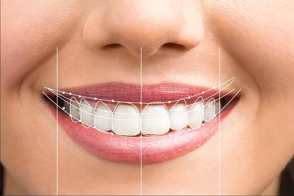 Nụ cười đẹp chưa có "chuẩn" quy định nào! Nụ cười đẹp chưa có