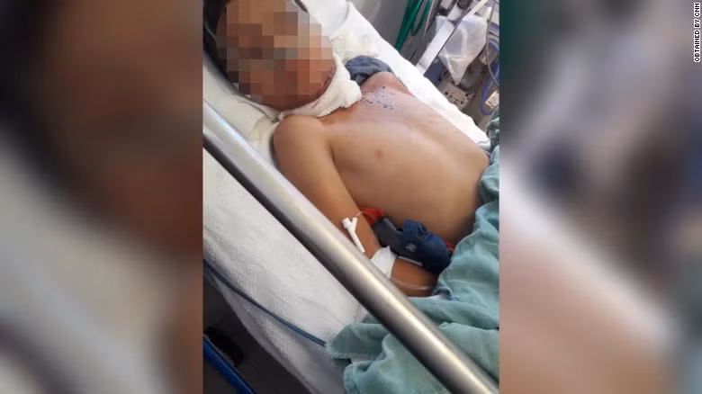 Cristian đang được chăm sóc tại bệnh viện (Ảnh: CNN) Cristian đang được chăm sóc tại bệnh viện (Ảnh: CNN)