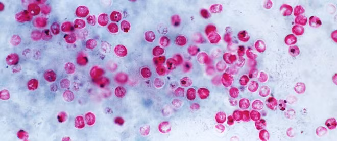 Ký sinh trùng Cryptosporidium (Crypto)