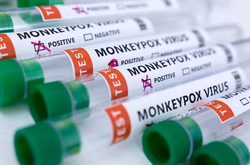 Đậu mùa khỉ liên quan tới virus đậu mùa từng bị xóa sổ trong thập kỷ 80, nhưng ít nghiêm trọng hơn (Ảnh: StraitTimes) Đậu mùa khỉ liên quan tới virus đậu mùa từng bị xóa sổ trong thập kỷ 80, nhưng ít nghiêm trọng hơn (Ảnh: StraitTimes)