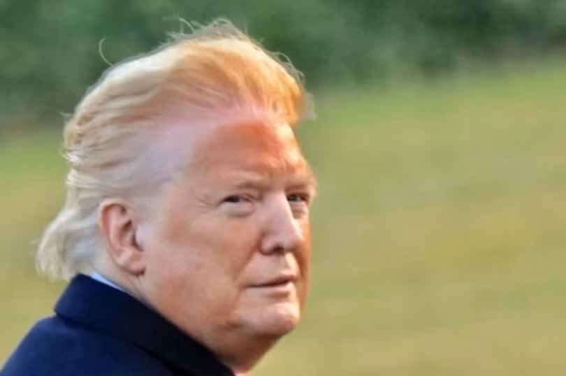 Bức ảnh chụp của William Moon cho thấy da mặt ông Trump có màu da cam, cùng một đường viền màu trắng chạy dọc chân tóc (Ảnh: William Moon)