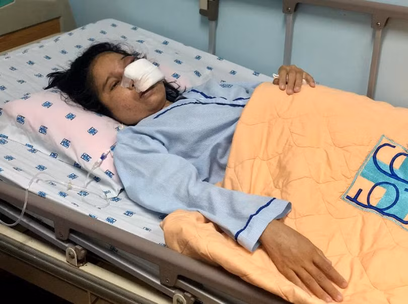 Cô giáo Xích Thị Cầm mắc bệnh u do nấm Mucormycosis, đang mang thai ở tuần thứ 29 Cô giáo Xích Thị Cầm mắc bệnh u do nấm Mucormycosis, đang mang thai ở tuần thứ 29