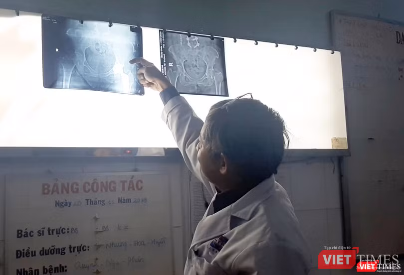 Bác sĩ Tăng Hà Nam Anh – Khoa Chấn thương Chỉnh hình (BV Nguyễn Tri Phương TP.HCM) chia sẻ về kỹ thuật thay khớp háng SuperPath và thay khớp gối Medial Pivot. Ảnh: NT