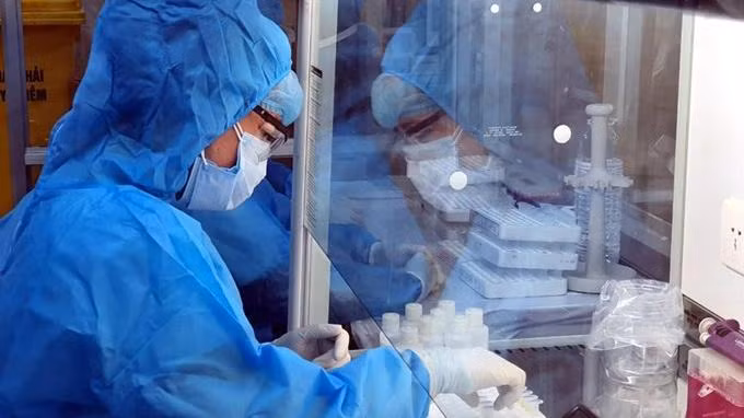 Xét nghiệm khẳng định COVID-19-Ảnh: HCDC