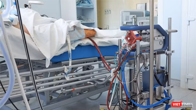 Bệnh nhân 91 phi công người Anh đang phụ thuộc hoàn toàn vào kỹ thuật ECMO (tim phổi nhân tạo) - Ảnh: SYT