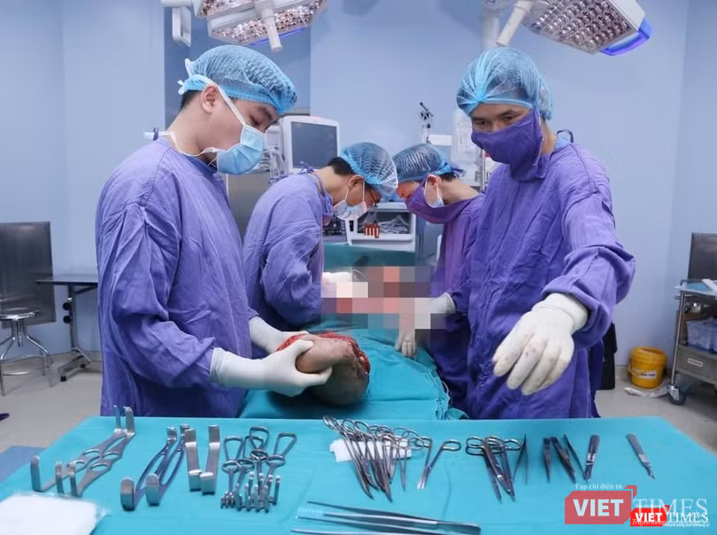 Các bác sĩ phẫu thuật đã bóc đi khối u khổng lồ (Ảnh: BVCC) Các bác sĩ phẫu thuật đã bóc đi khối u khổng lồ (Ảnh: BVCC)