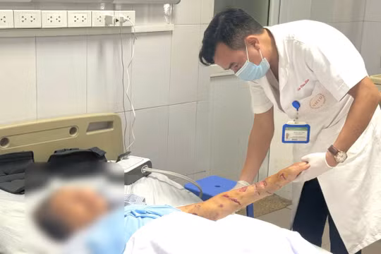 Hai người cao tuổi bị chó nhà cắn, bác sĩ cảnh báo