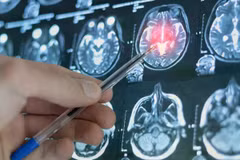 Các nhà nghiên cứu đã tiến hành chụp cộng hưởng từ (MRI) trên những người tham gia thử nghiệm để xem họ phản ứng như thế nào với các biểu cảm khuôn mặt. Ảnh: Shutterstock.