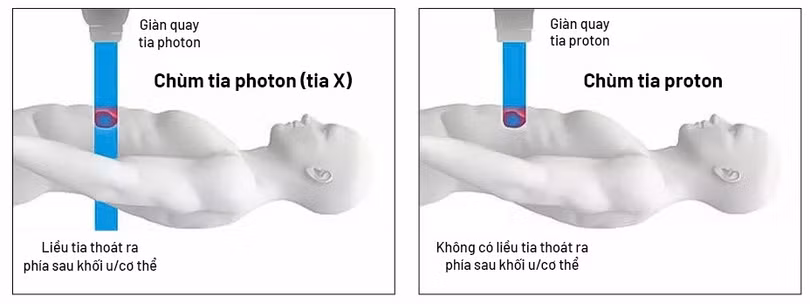 pr2.jpg