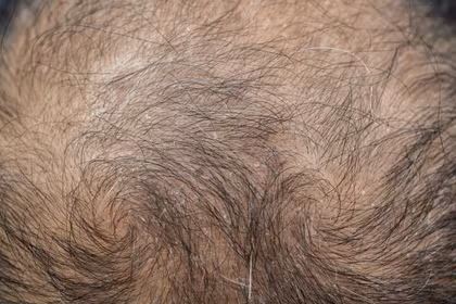 Ảnh minh họa: PM.