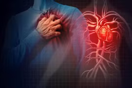Sử dụng NSAID có liên quan đến tăng nguy cơ nhập viện vì suy tim lần đầu với bệnh nhân bệnh tiểu đường loại 2. Ảnh ScitechDaily.