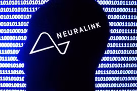 Liên doanh y tế Neuralink. Ảnh CNBC